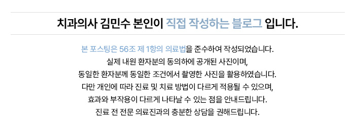 전악 임플란트 치료 전후 및 치료 기간 안내