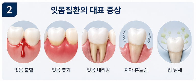 잇몸치료 대상