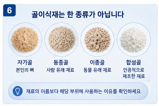 임플란트 골이식재 종류, 자가골 동종골 이종골 합성골