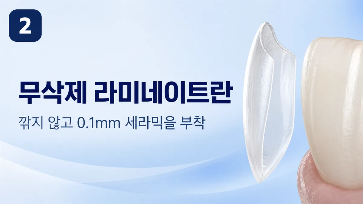 무삭제 라미네이트 — 깎지 않고 0.1mm 세라믹 부착