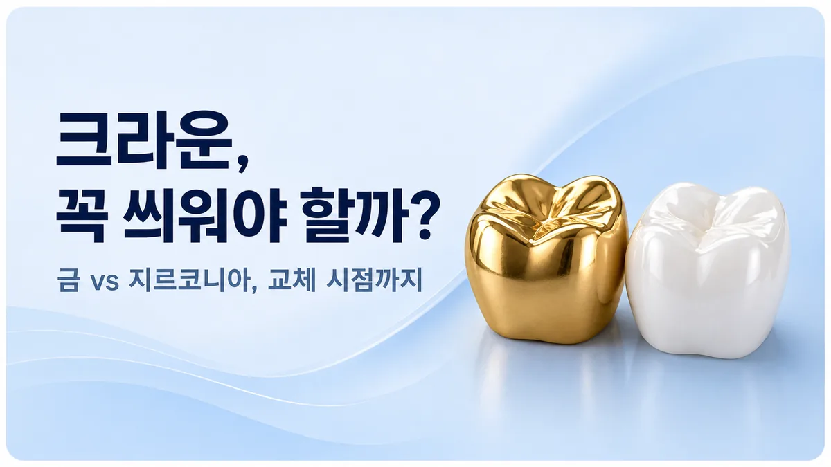 강동구 크라운 — 꼭 씌워야 할까? 재료 선택과 교체 시점 가이드