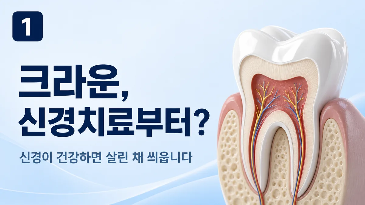 크라운과 신경치료 — 신경이 건강하면 살린 채 씌웁니다