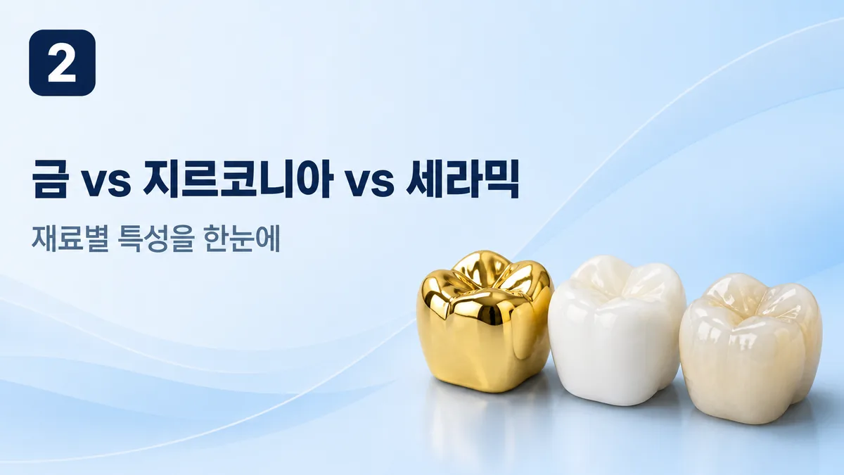 금 vs 지르코니아 vs 세라믹 — 크라운 재료 비교