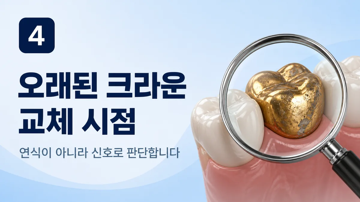 오래된 크라운 교체 시점 — 연식이 아니라 신호로 판단