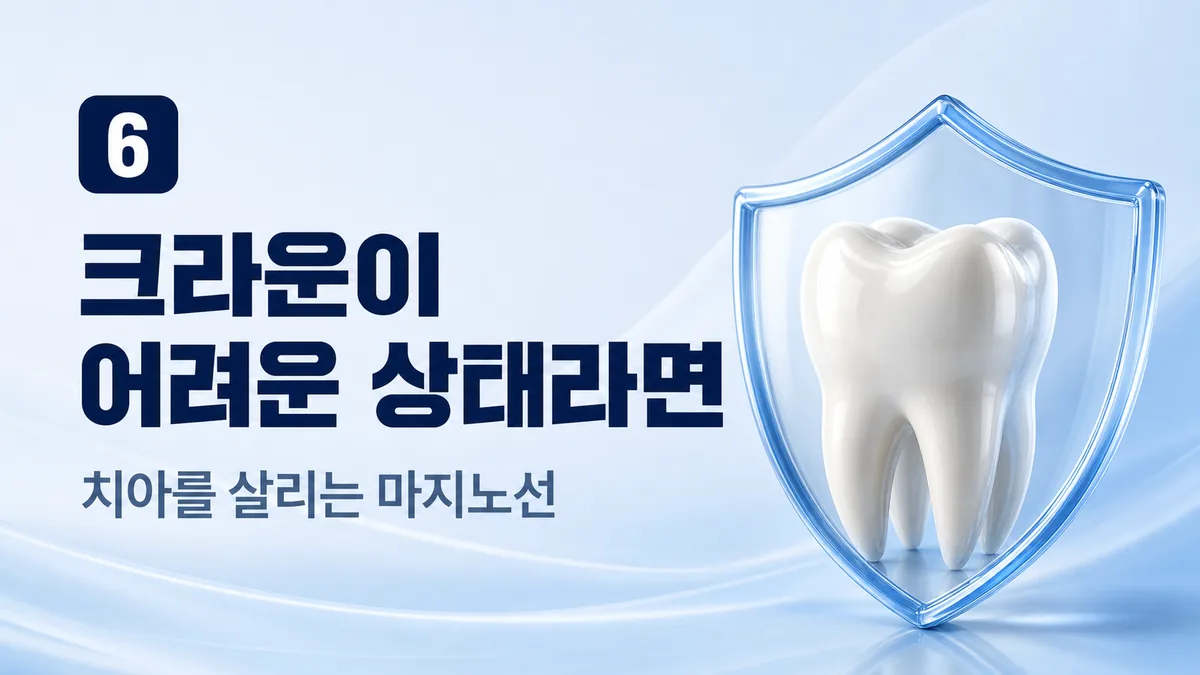 크라운이 어려운 상태라면 — 치아를 살리는 마지노선