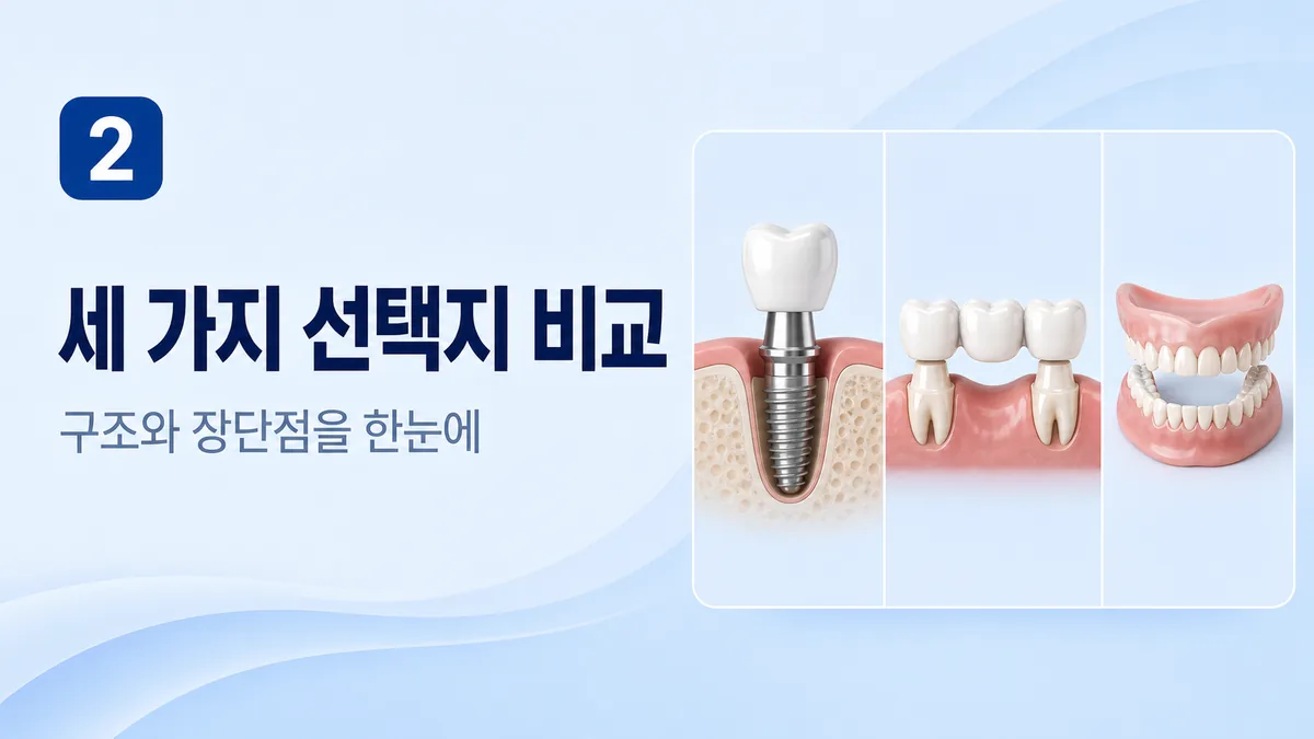 임플란트·브릿지·틀니 세 가지 선택지 비교