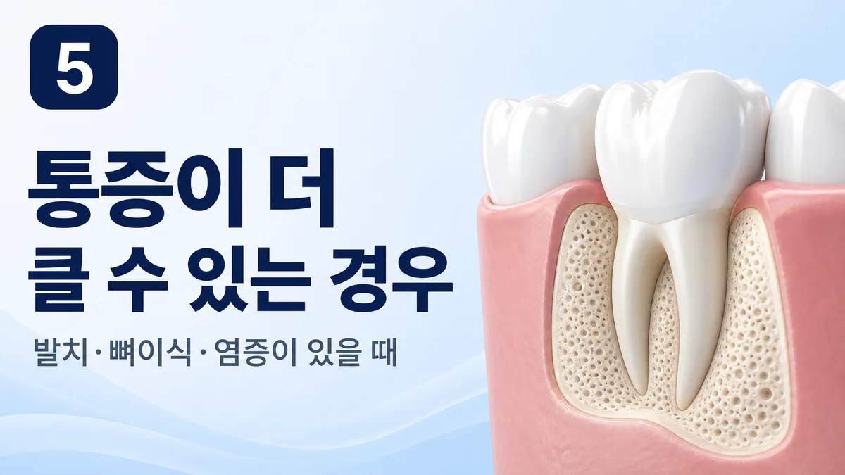 통증이 더 클 수 있는 경우 — 발치·뼈이식·염증
