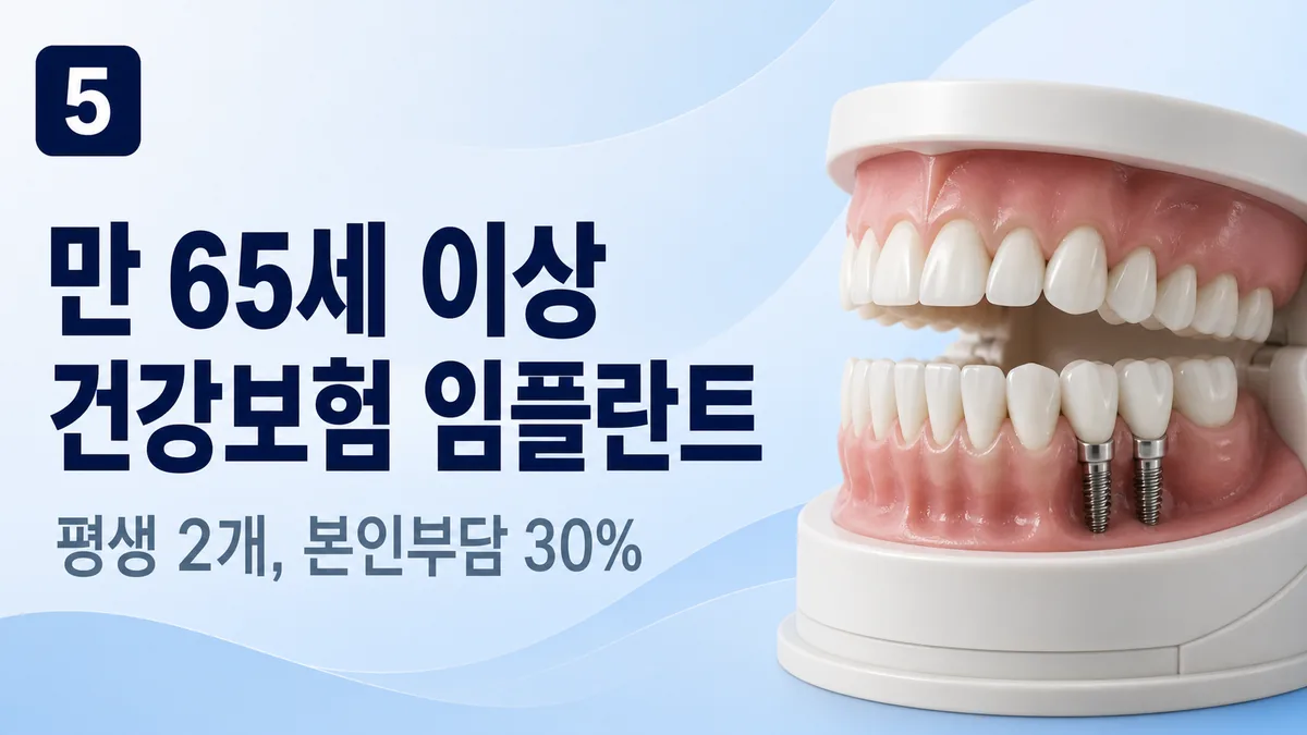 만 65세 이상 건강보험 임플란트 — 평생 2개, 본인부담 30%