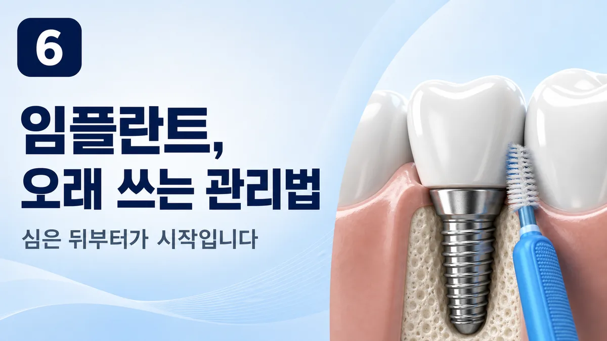 임플란트 오래 쓰는 관리법 — 심은 뒤부터가 시작