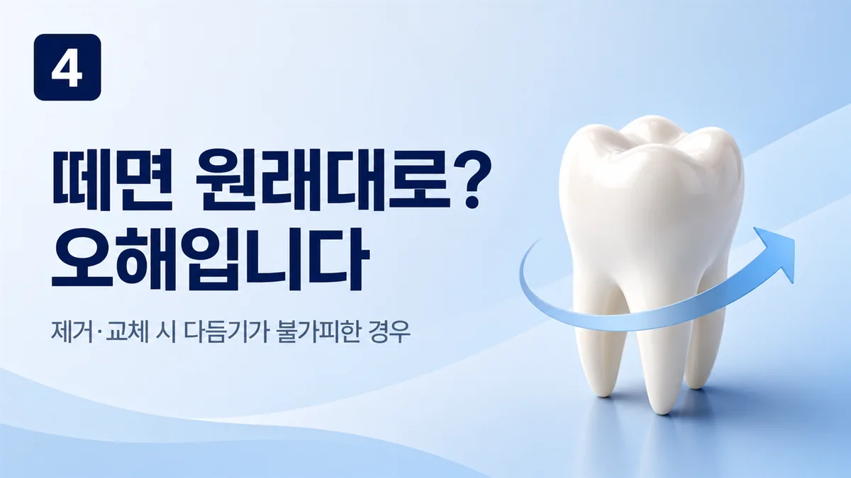 라미네이트는 제거·교체 시 다듬기가 불가피한 경우가 많습니다