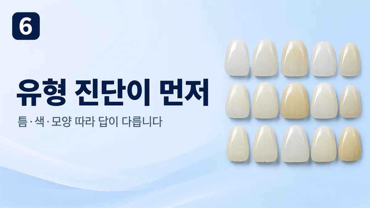 앞니 고민은 틈·색·모양 유형 진단이 먼저입니다