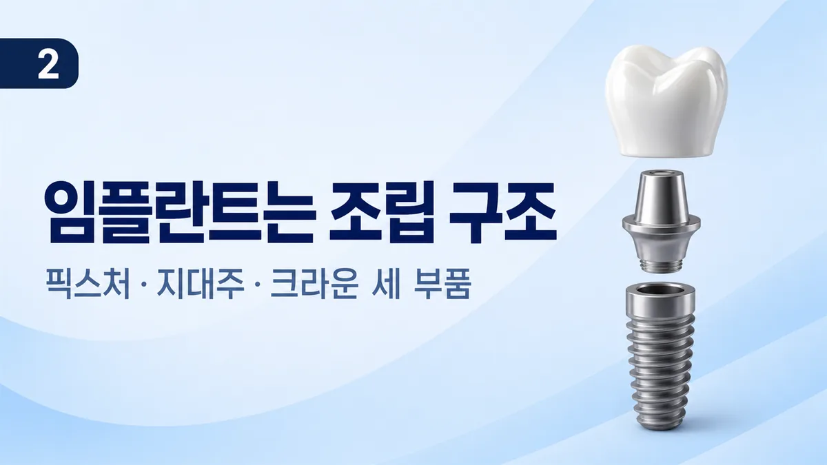 임플란트는 픽스처·지대주·크라운 세 부품의 조립 구조입니다