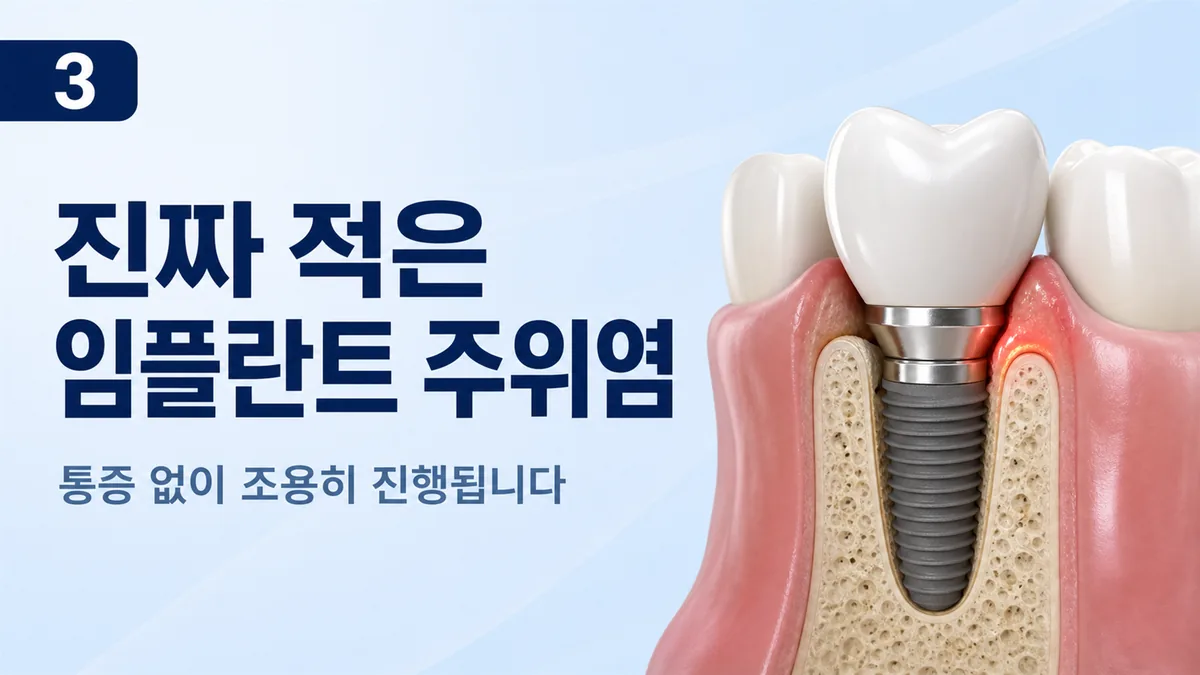 임플란트 주위염은 통증 없이 조용히 진행됩니다