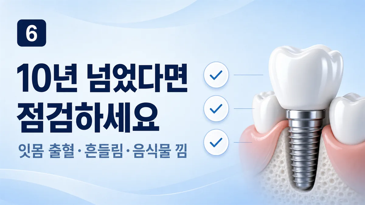 10년 넘은 임플란트는 잇몸 출혈·흔들림·음식물 낌을 점검하세요