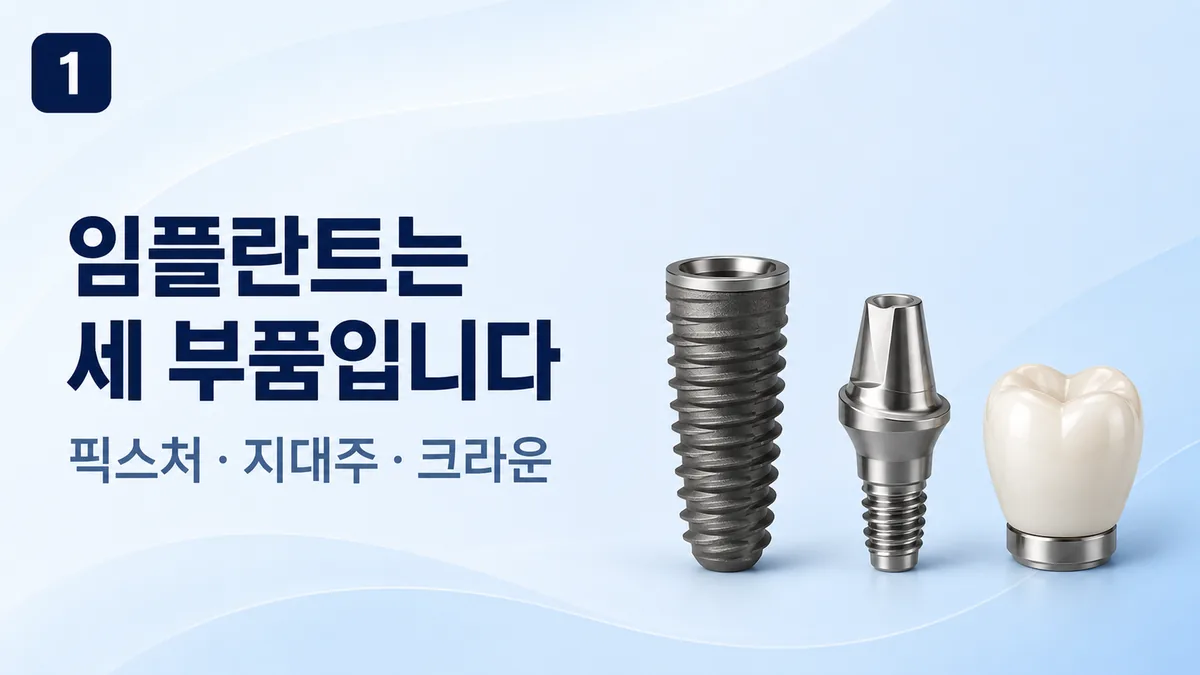 임플란트는 세 부품, 픽스처·지대주·크라운