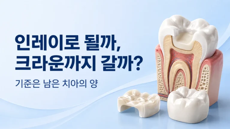 강동구 크라운 안내, 인레이로 될지 크라운까지 갈지는 남은 치아의 양으로 정합니다