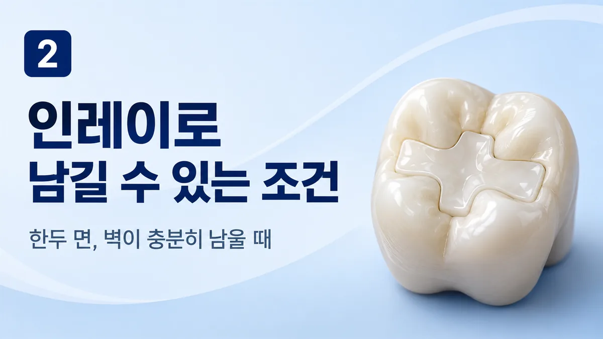 인레이로 남길 수 있는 조건, 한두 면 손상과 충분한 벽