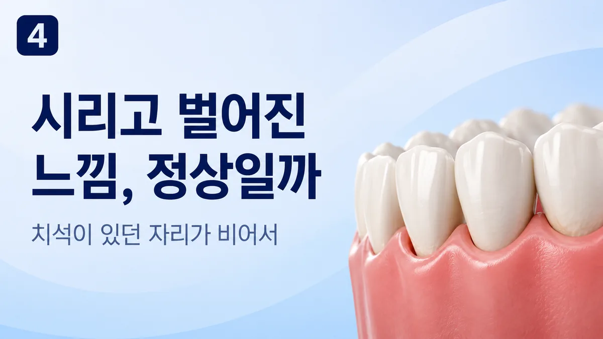스케일링 후 시리고 벌어진 느낌, 치석이 있던 자리가 비어서