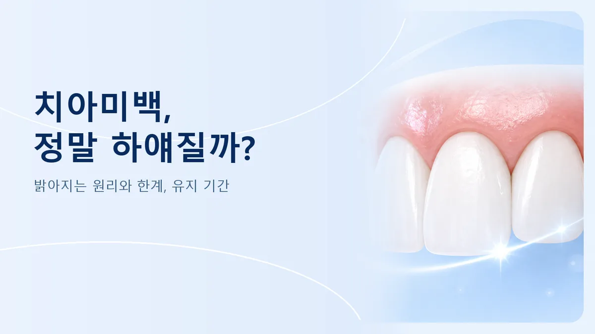 강동구 치아미백 안내, 밝아지는 원리와 한계, 유지 기간