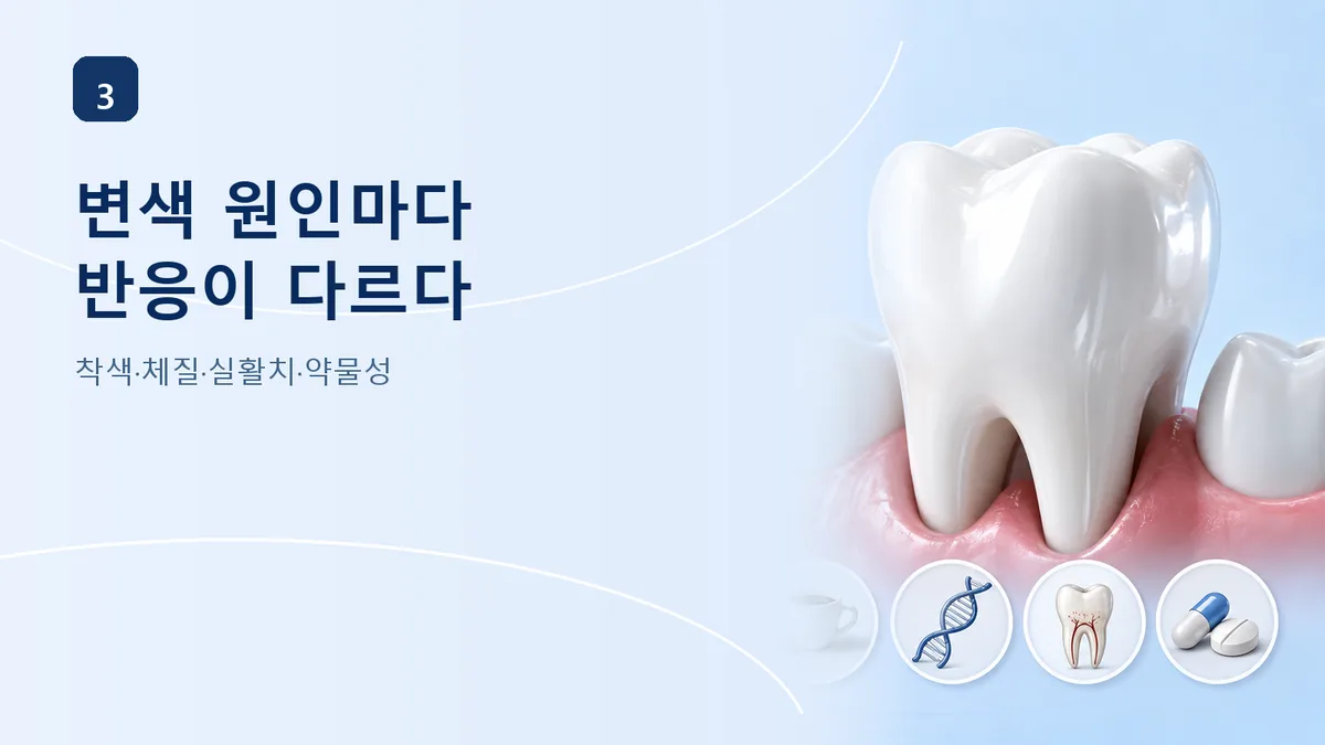변색 원인마다 미백 반응이 다르다, 착색·체질·실활치·약물성