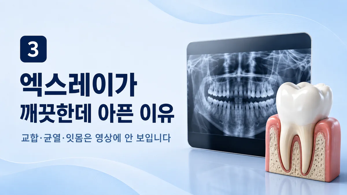 엑스레이가 깨끗한데 아픈 이유, 교합·균열·잇몸