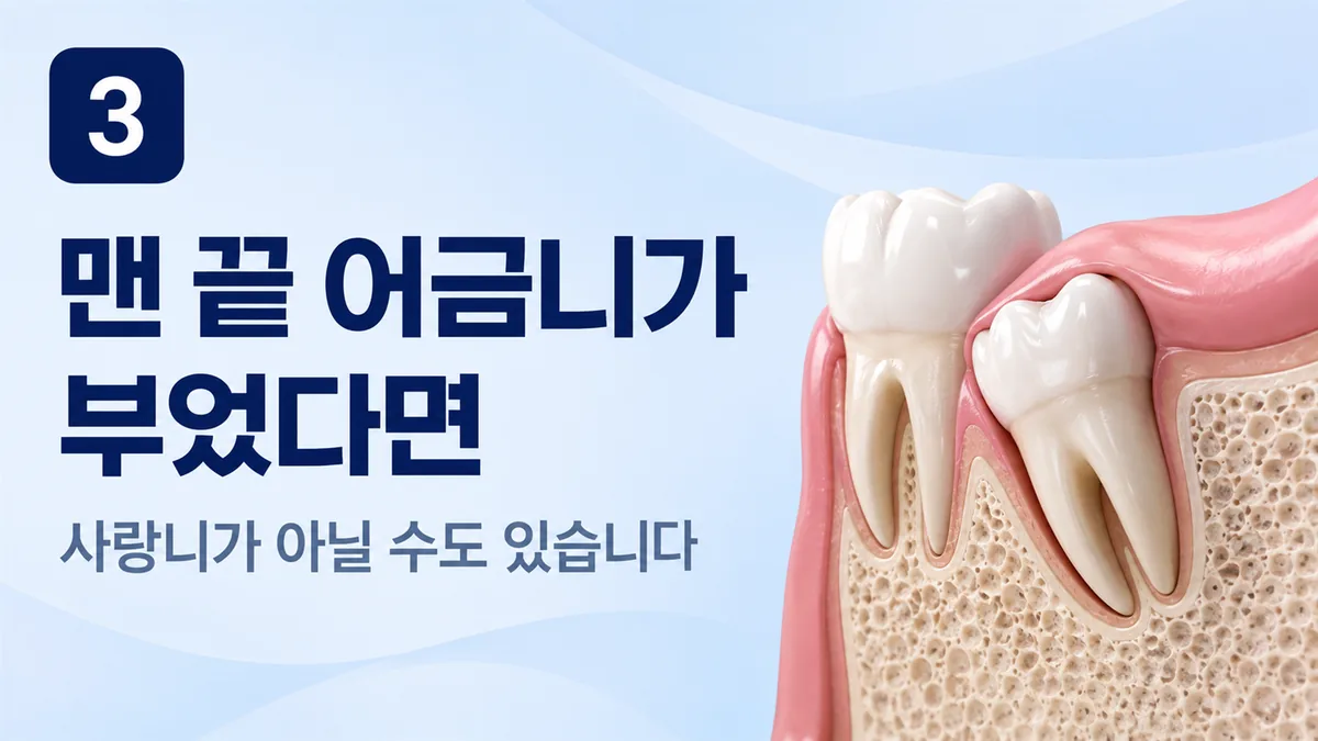 맨 끝 어금니가 부었다면 사랑니가 아닐 수도 있습니다