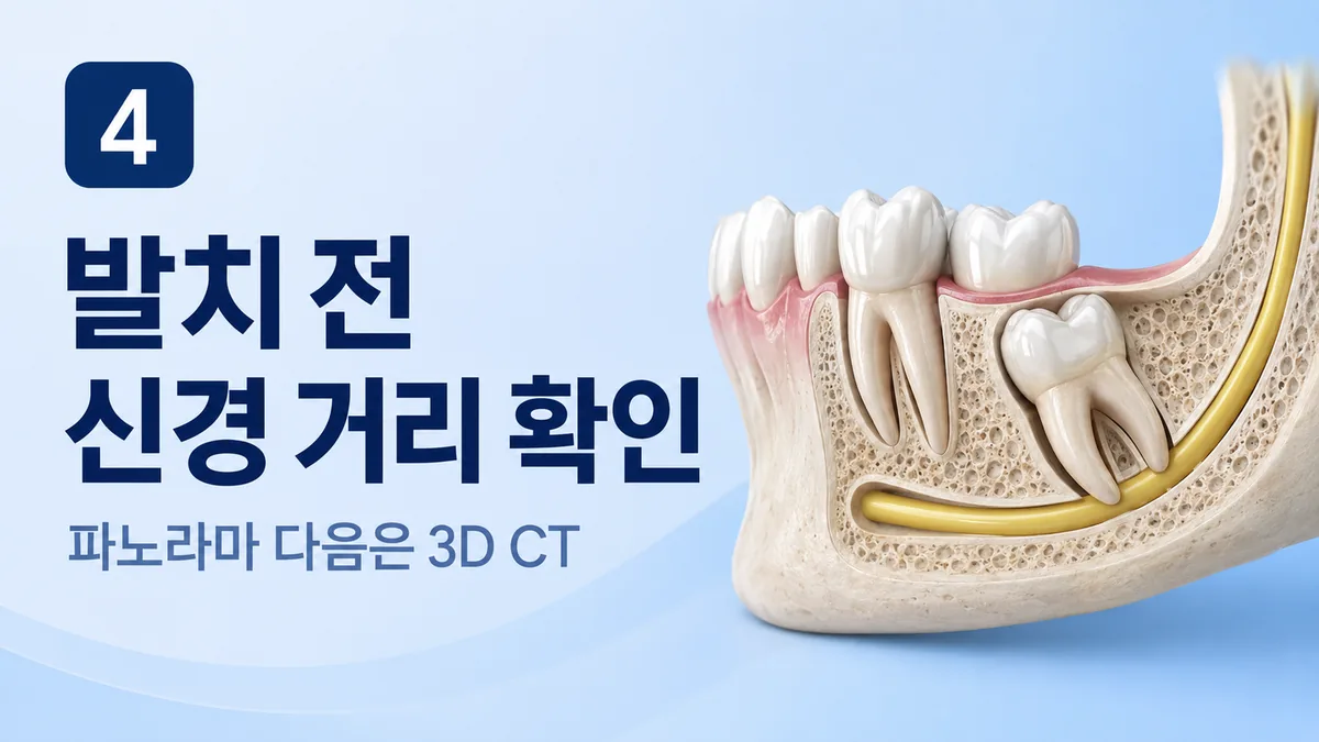 발치 전 신경 거리 확인, 파노라마 다음은 3D CT