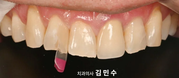 바이오클리어