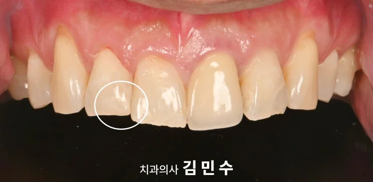 블랙 트라이앵글