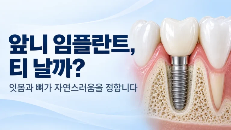앞니 임플란트, 티 날까, 잇몸과 뼈가 자연스러움을 정합니다