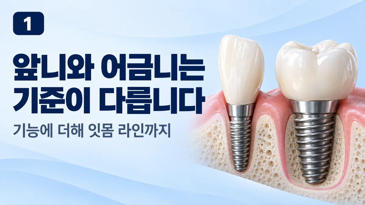 앞니와 어금니는 기준이 다릅니다, 기능에 더해 잇몸 라인까지