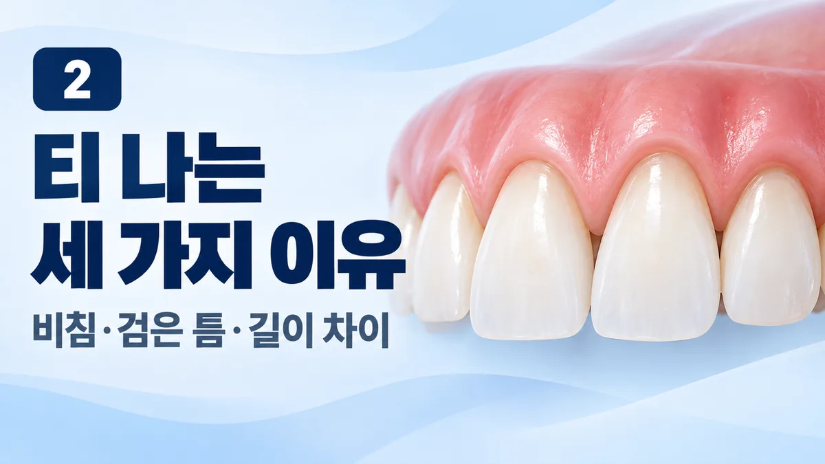 티 나는 세 가지 이유, 비침·검은 틈·길이 차이
