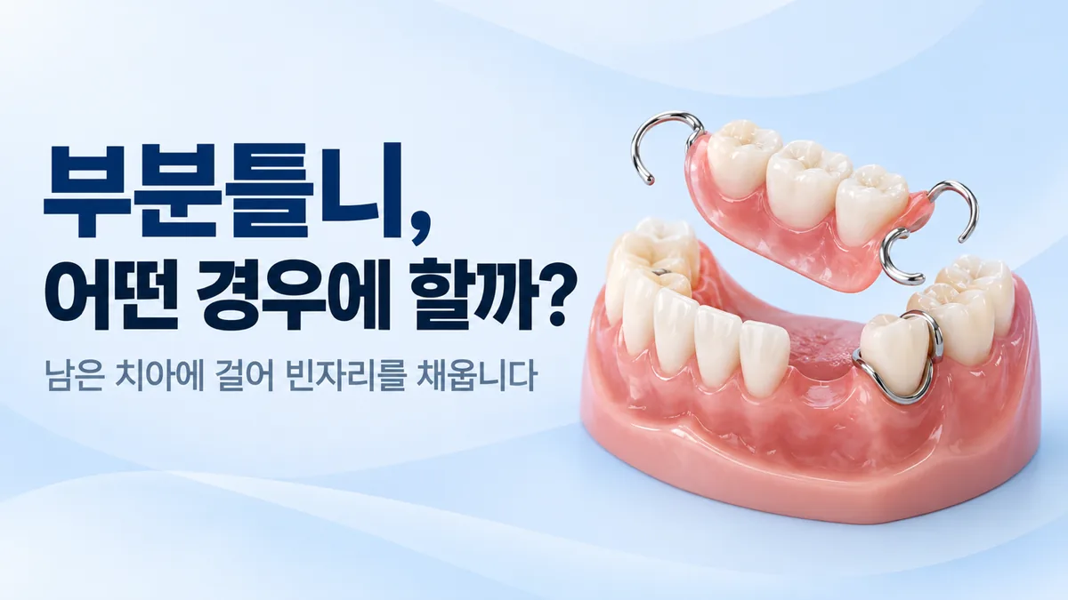 강동구 부분틀니 안내, 남은 치아에 걸어 빈자리를 채우는 틀니