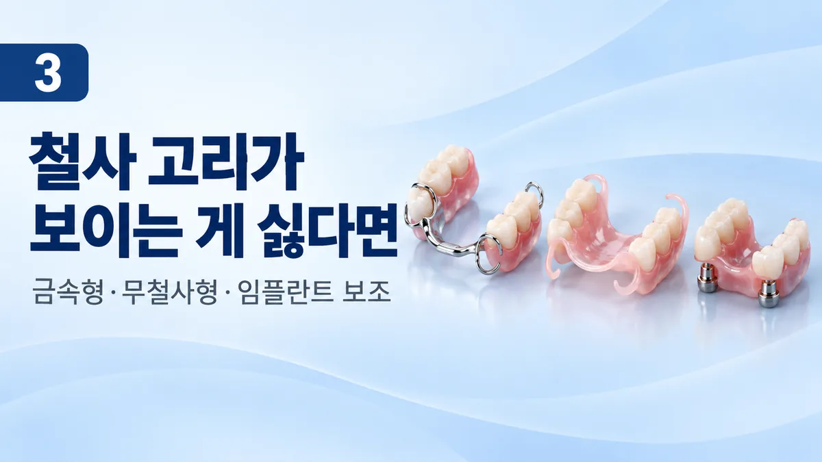 철사 고리가 보이는 게 싫을 때, 금속형·무철사형·임플란트 보조 비교