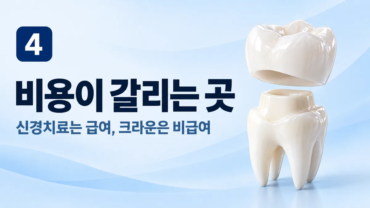 비용이 갈리는 곳, 신경치료는 급여, 크라운은 비급여