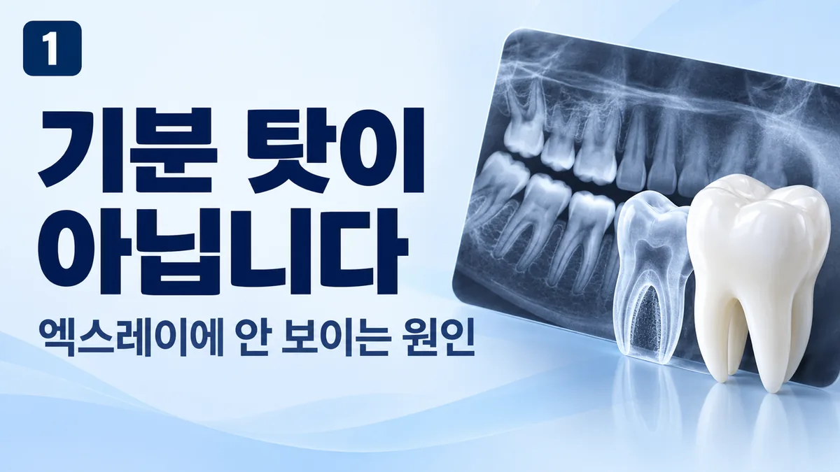 기분 탓이 아닙니다, 엑스레이에 안 보이는 원인