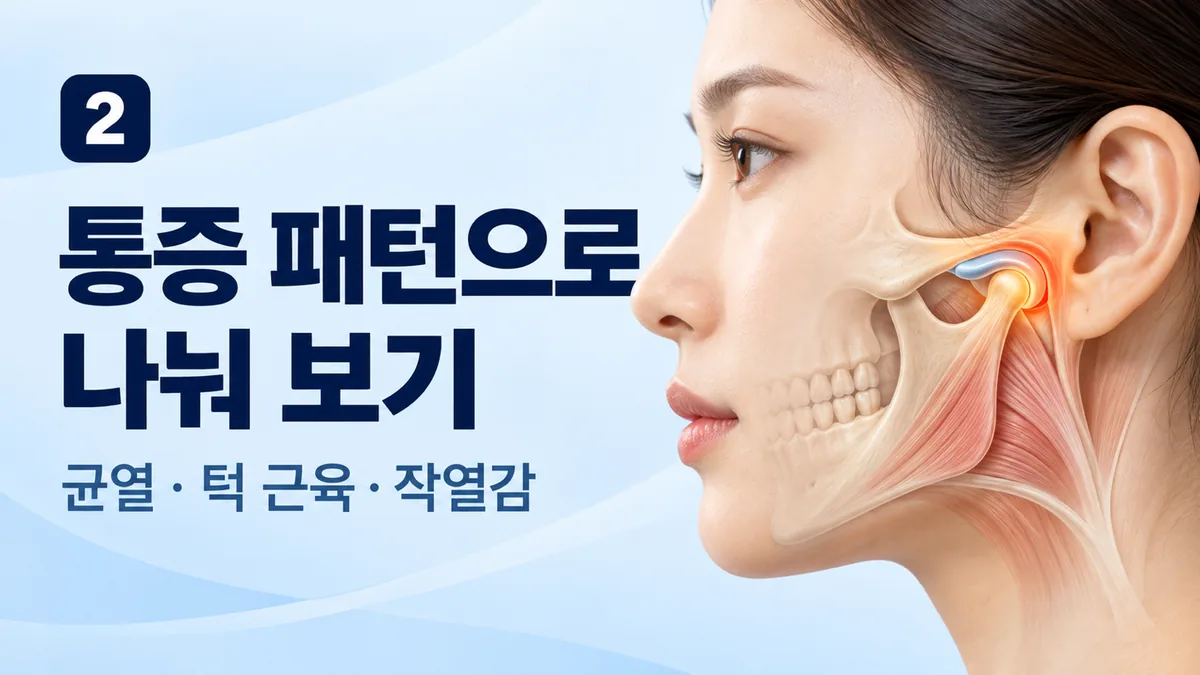 통증 패턴으로 나눠 보기, 균열·턱 근육·작열감