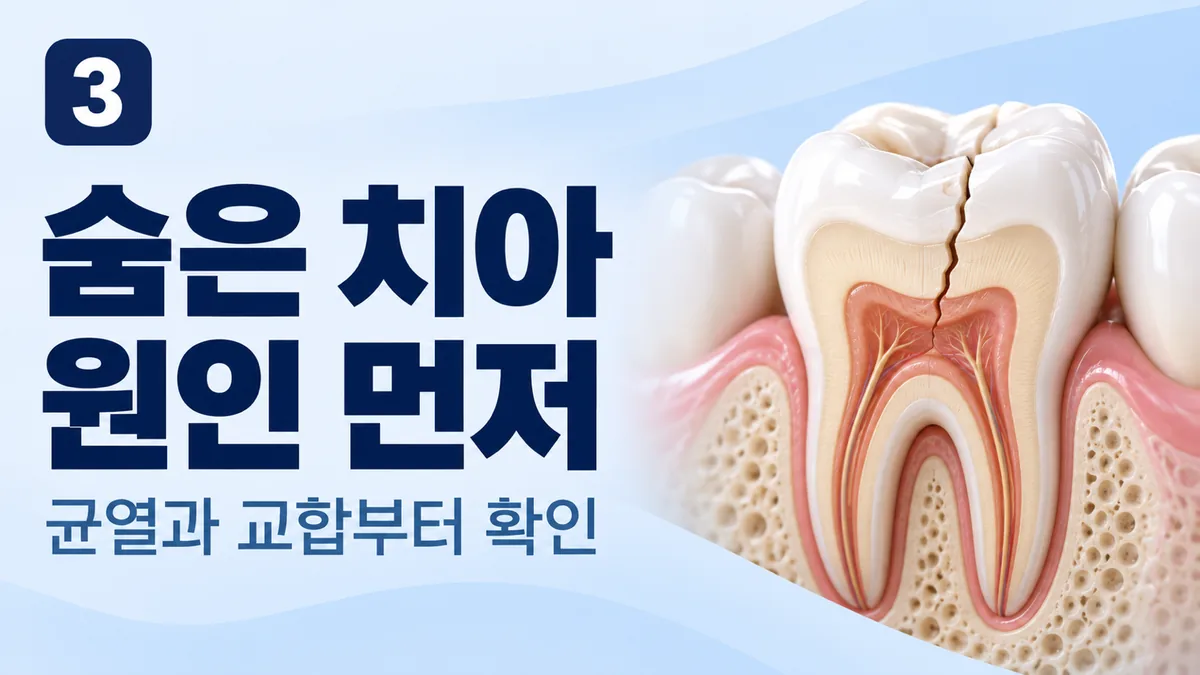 숨은 치아 원인 먼저, 균열과 교합부터 확인