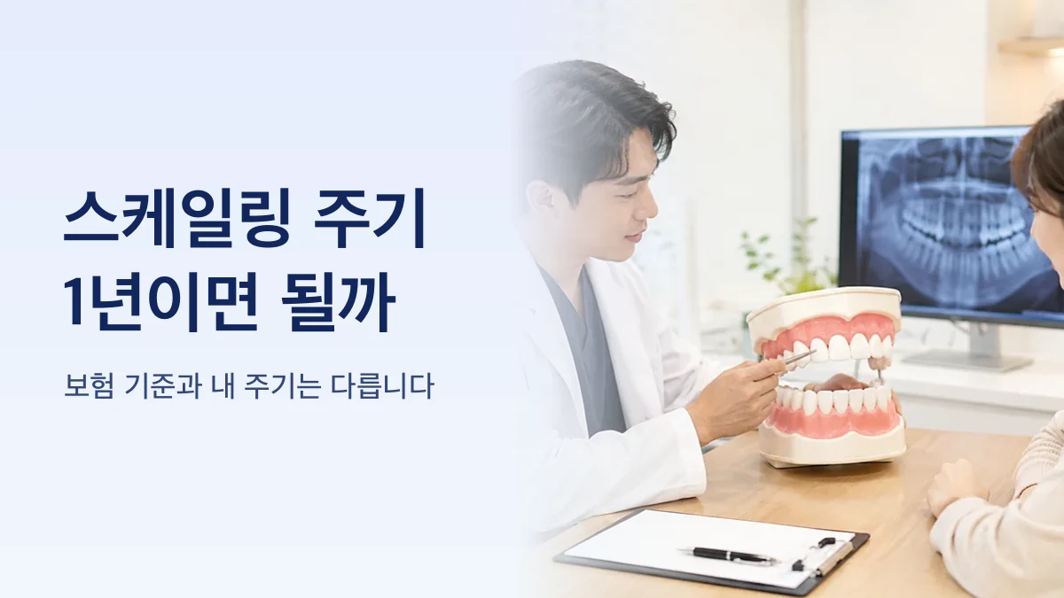 상태별 스케일링 권장 주기를 비교한 그림