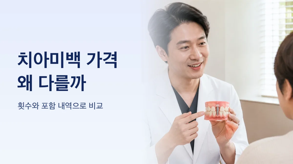 치아미백 가격을 가르는 요소를 정리한 그림
