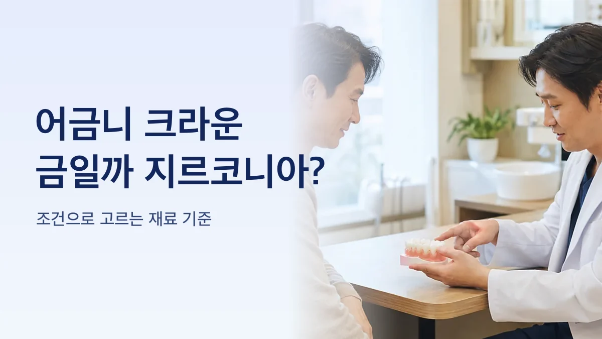 어금니 크라운 재료 금과 지르코니아를 비교한 그림
