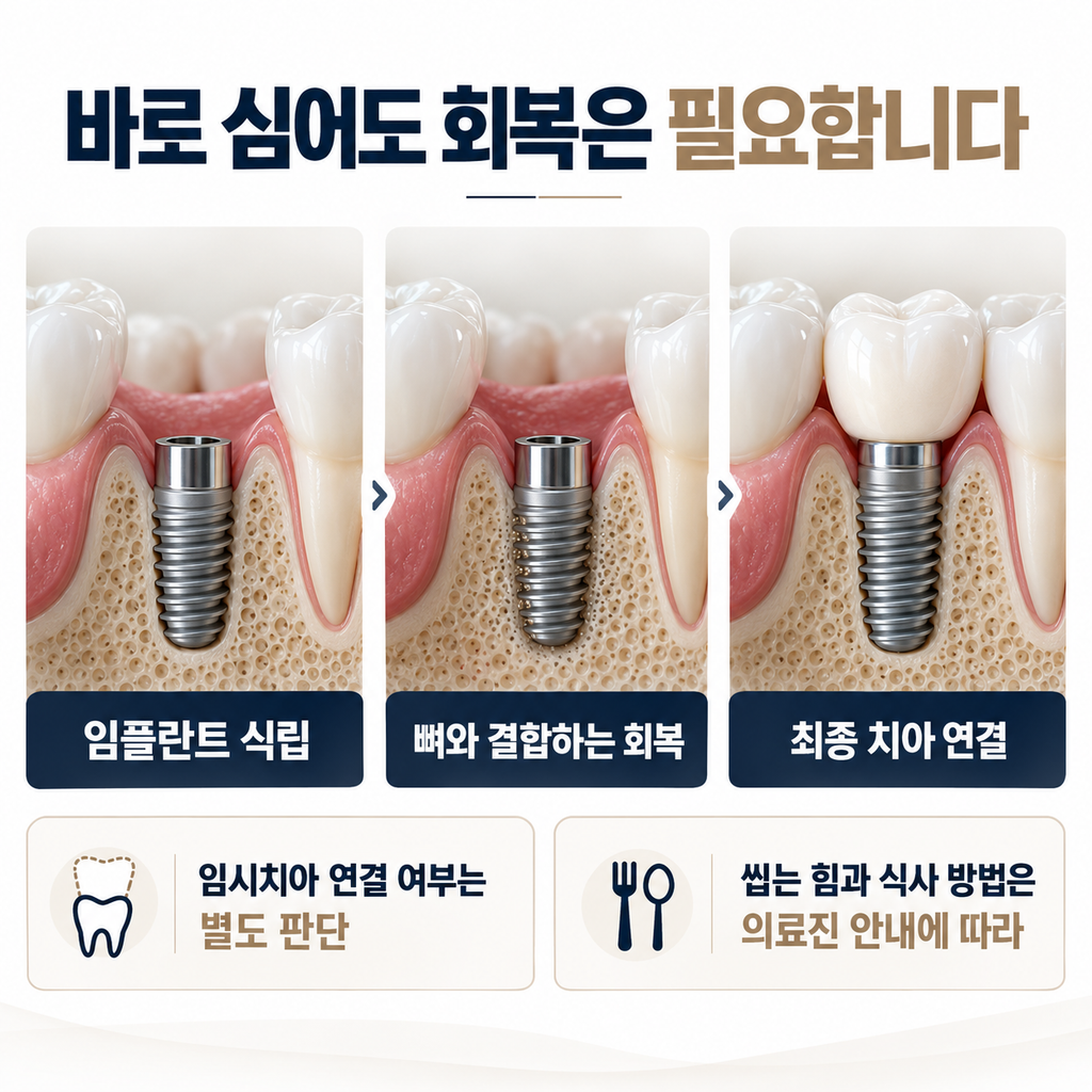 발치즉시 임플란트